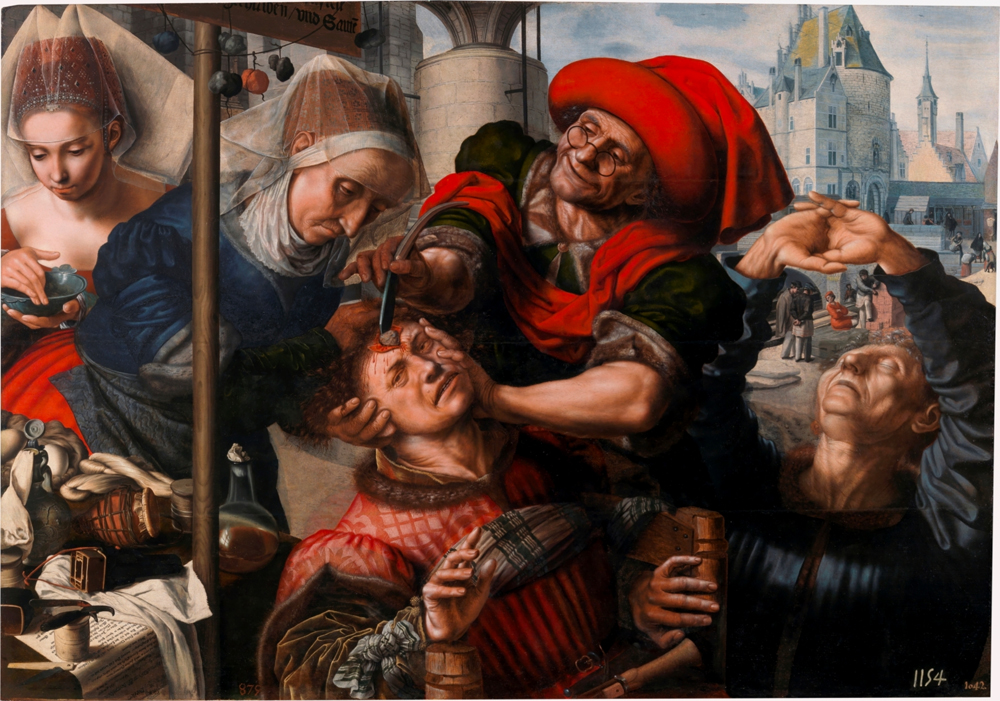 tableau de Jan Sanders van Hemessen, L’Extraction de la pierre de folie (1550) illustrant la pratique médiévale de la lithotomie, conservé au musée du Prado